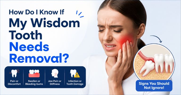 how do I know if my wisdom tooth needs removal