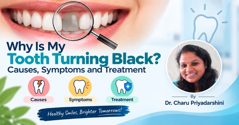 Why Is My Tooth Turning Black Causes, Symptoms and Treatment